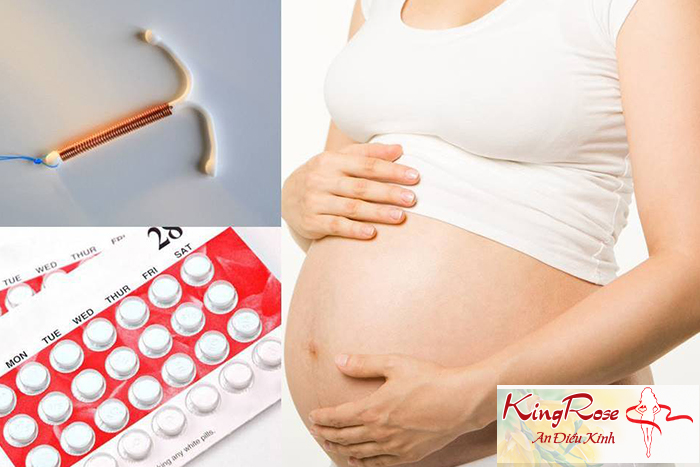 Nên lựa chọn biện pháp tránh thai nào sau sinh?